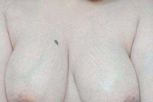 Doctor Big Boobs Xxx