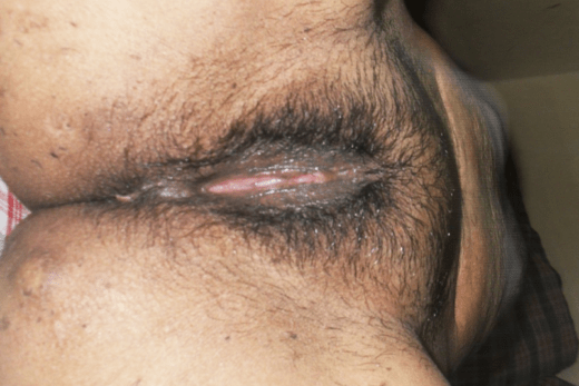 Bhabhi