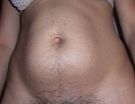Hairy Pussy